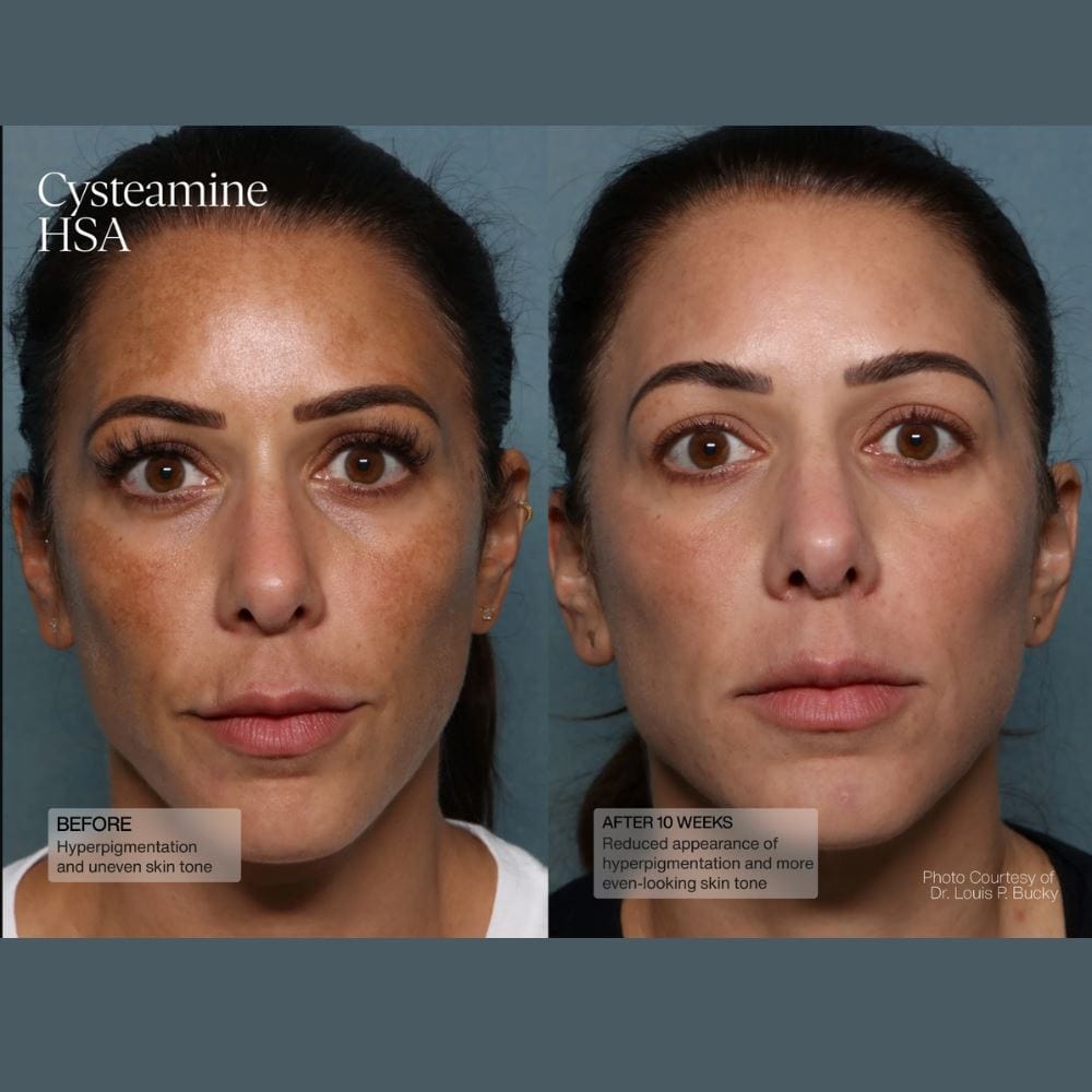 Sente Cysteamine HSA Pigment & Tone Corrector SENTE Shop at Exclusive Beauty