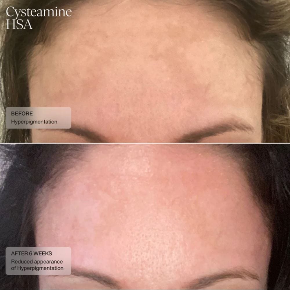 Sente Cysteamine HSA Pigment & Tone Corrector SENTE Shop at Exclusive Beauty