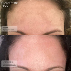 Sente Cysteamine HSA Pigment & Tone Corrector SENTE Shop at Exclusive Beauty Club