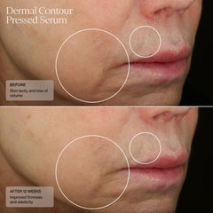 SENTE Dermal Contour Pressed Serum SENTE Shop at Exclusive Beauty
