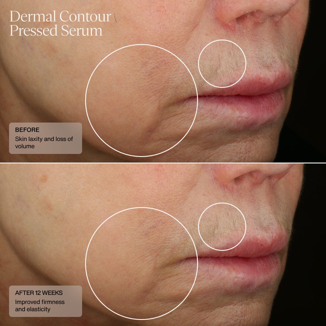 SENTE Dermal Contour Pressed Serum SENTE Shop at Exclusive Beauty