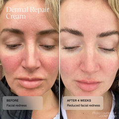 Senté Dermal Repair Cream SENTE Shop at Exclusive Beauty