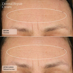 Senté Dermal Repair Cream SENTE Shop at Exclusive Beauty Club