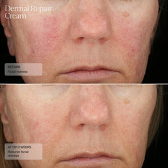 Senté Dermal Repair Cream SENTE Shop at Exclusive Beauty Club