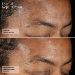 Senté Dermal Repair Cream SENTE Shop at Exclusive Beauty