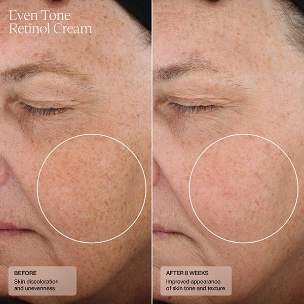 Sente Even Tone Retinol Cream SENTE Shop at Exclusive Beauty