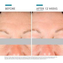 Load image into Gallery viewer, SkinCeuticals A.G.E Interrupter Advanced SkinCeuticals Shop at Exclusive Beauty Club
