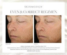 Carregar imagem no visualizador da Galeria, SkinMedica Even &amp; Correct Treatment Trio SkinMedica Shop at Exclusive Beauty Club
