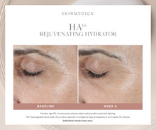 将图片加载到图库查看器，SkinMedica HA5 Rejuvenating Hydrator Before &amp; After SkinMedica Shop at Exclusive Beauty Club
