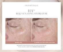 Charger l&#39;image dans la visionneuse de galerie, SkinMedica HA5 Rejuvenating Hydrator SkinMedica Shop at Exclusive Beauty Club
