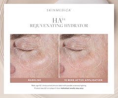 SkinMedica HA5 Rejuvenating Hydrator Face Moisturizers SkinMedica Shop at Exclusive Beauty