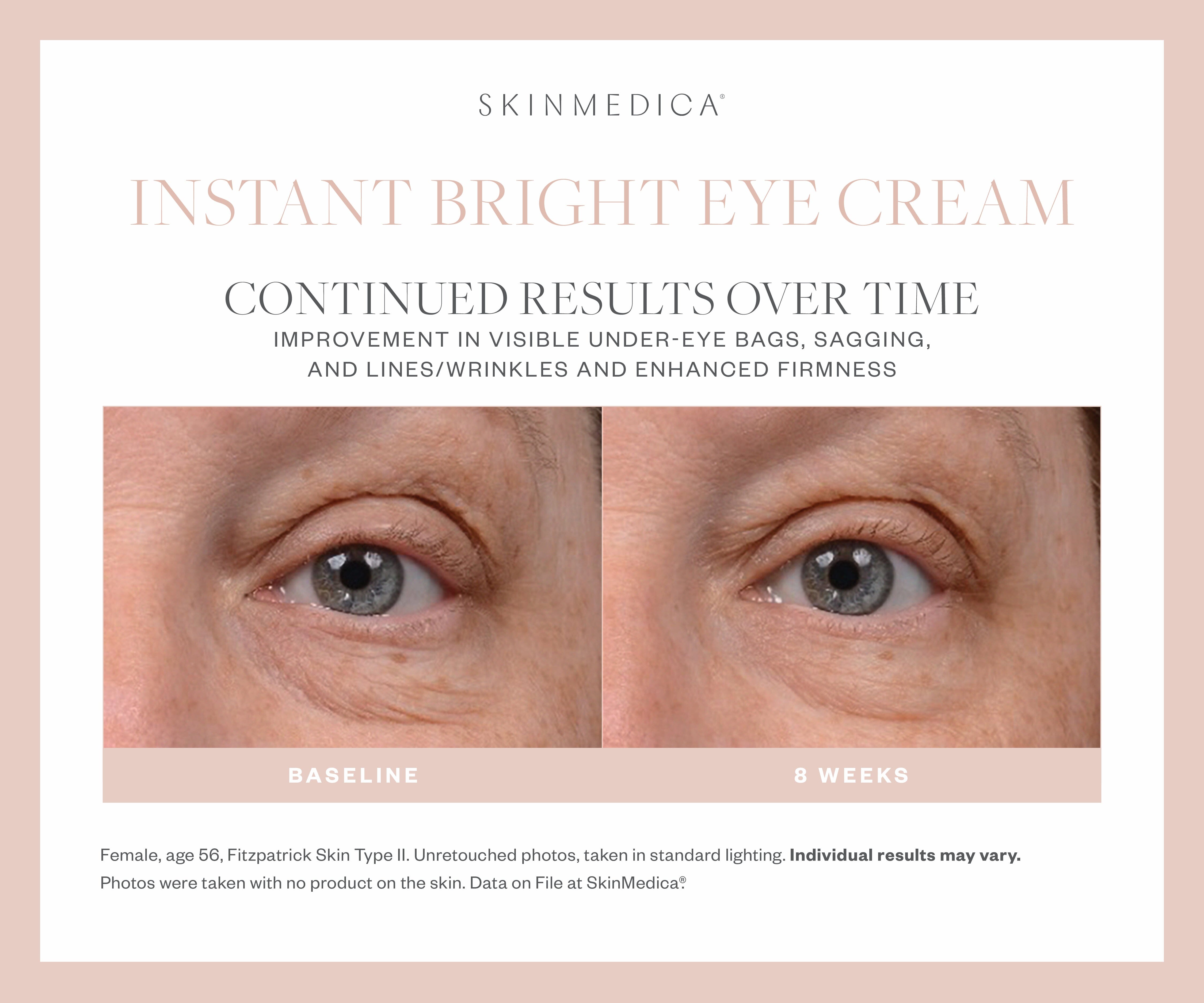 SkinMedica Instant Bright Eye Cream SkinMedica Shop at Exclusive Beauty Club