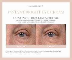 SkinMedica Instant Bright Eye Cream SkinMedica Shop at Exclusive Beauty Club