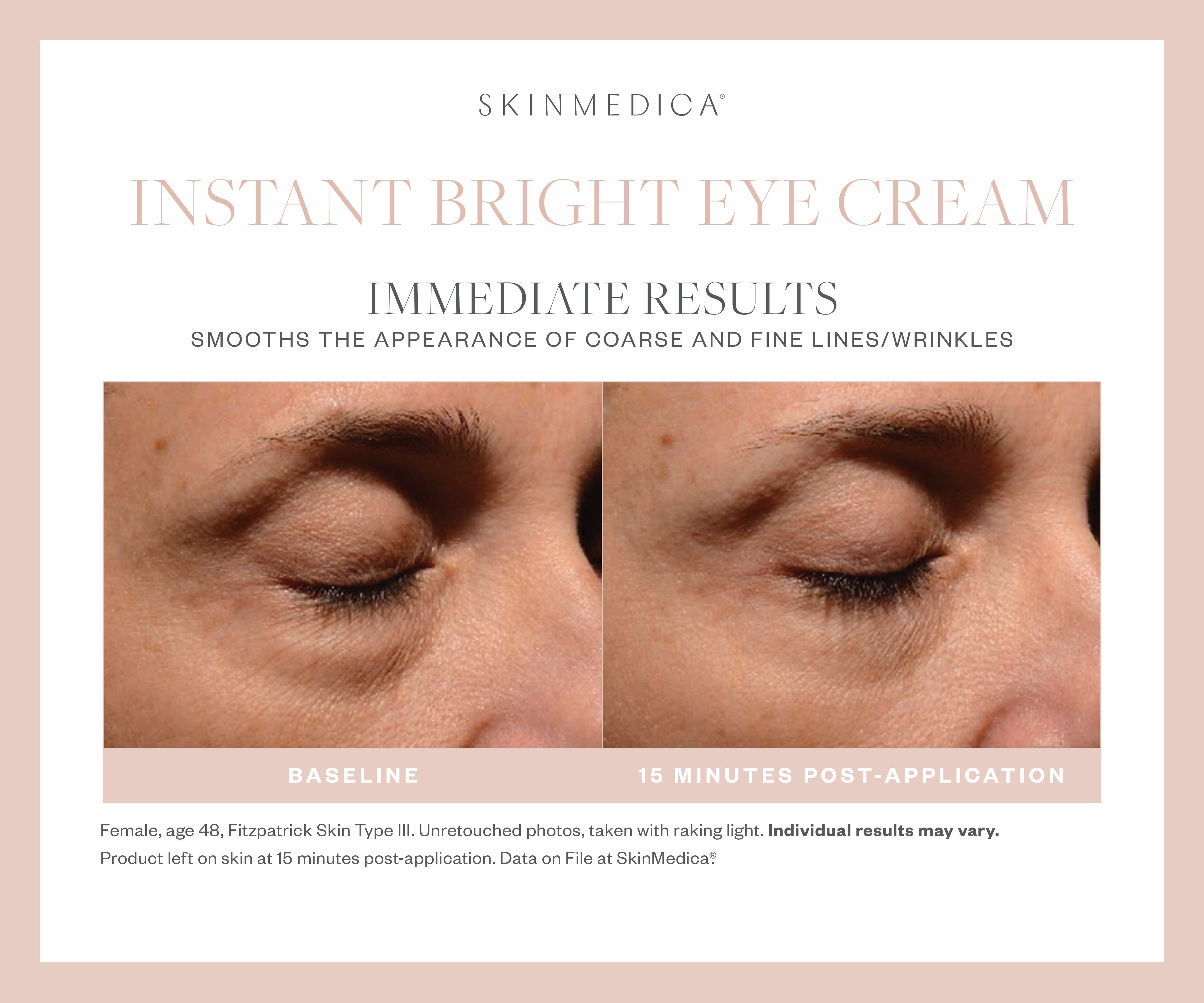 SkinMedica Instant Bright Eye Cream SkinMedica Shop at Exclusive Beauty Club