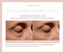 Charger l&#39;image dans la visionneuse de galerie, SkinMedica Instant Bright Eye Cream SkinMedica Shop at Exclusive Beauty Club
