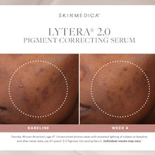 将图片加载到图库查看器，SkinMedica Lytera 2.0 Pigment Correcting Serum SkinMedica Shop at Exclusive Beauty Club
