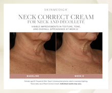 Charger l&#39;image dans la visionneuse de galerie, SkinMedica Neck Correct Cream SkinMedica Shop at Exclusive Beauty Club
