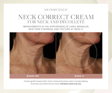 Charger l&#39;image dans la visionneuse de galerie, SkinMedica Neck Correct Cream SkinMedica Shop at Exclusive Beauty Club

