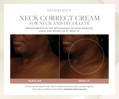 SkinMedica Neck Correct Cream SkinMedica Shop at Exclusive Beauty