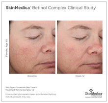 将图片加载到图库查看器，SkinMedica Retinol Complex 1.0 SkinMedica Shop at Exclusive Beauty Club
