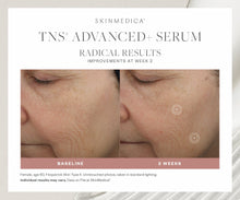 Charger l&#39;image dans la visionneuse de galerie, SkinMedica TNS Advanced+ Serum SkinMedica Shop at Exclusive Beauty Club
