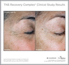 将图片加载到图库查看器，SkinMedica TNS Recovery Complex SkinMedica Shop at Exclusive Beauty Club
