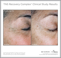 SkinMedica TNS Recovery Complex SkinMedica Shop at Exclusive Beauty Club