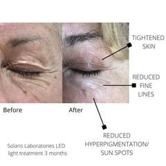 Solaris Laboratories NY How To Glow 4 Color LED Light Therapy Mask Solaris Laboratories NY Shop at Exclusive Beauty